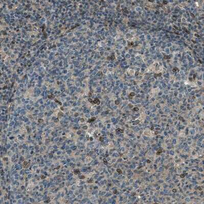 Immunohistochemistry-Paraffin: LEMD2 Antibody [NBP1-85175] - Staining of human lymph node shows moderate to strong positivity in nuclear membrane in a subset of germinal center cells.