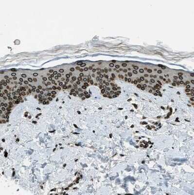 Immunohistochemistry-Paraffin: LEMD2 Antibody [NBP1-85175] - Staining of human skin shows moderate to strong positivity in nuclear membrane in squamous epithelial cells.