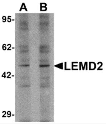 Western Blot LEMD2 Antibody - BSA Free