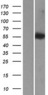 Western Blot: LEMD2 Overexpression Lysate (Adult Normal) [NBP2-04930] Left-Empty vector transfected control cell lysate (HEK293 cell lysate); Right -Over-expression Lysate for LEMD2.