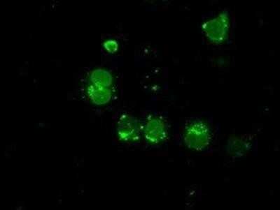 Immunocytochemistry/Immunofluorescence: LEMD3 Antibody (OTI6C10) - Azide and BSA Free [NBP2-71744] - Staining of COS7 cells transiently transfected by pCMV6-ENTRY LEMD3.