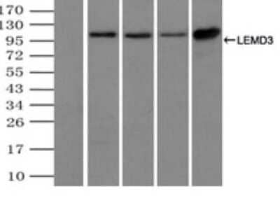 Immunoprecipitation: LEMD3 Antibody (OTI6C10) - Azide and BSA Free [NBP2-71744] - (Negative control: IP without adding anti-LEMD3 antibody). For each experiment, 500ul of DDK tagged LEMD3 overexpression lysates (at 1:5 dilution with HEK293T lysate), 2ug of anti-LEMD3 antibody and 20ul (0.1mg) of goat anti-mouse conjugated magnetic beads were mixed and incubated overnight. After extensive wash to remove any non-specific binding, the immuno-precipitated products were analyzed with rabbit anti-DDK polyclonal antibody.