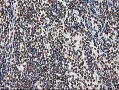 Immunohistochemistry: LENG1 Antibody (OTI10A7) - Azide and BSA Free [NBP2-72202] - Staining of paraffin-embedded Human lymphoma tissue using anti-LENG1 mouse monoclonal antibody.