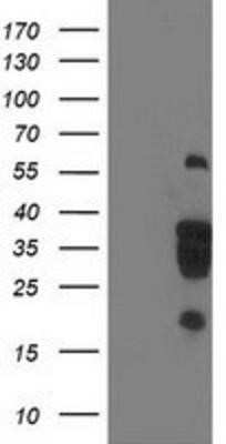 Western Blot: LENG1 Antibody (OTI10A7) - Azide and BSA Free [NBP2-72202] - HEK293T cells were transfected with the pCMV6-ENTRY control (Left lane) or pCMV6-ENTRY LENG1 (Right lane) cDNA for 48 hrs and lysed. Equivalent amounts of cell lysates (5 ug per lane) were separated by SDS-PAGE and immunoblotted with anti-LENG1.