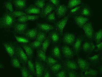 Immunocytochemistry/Immunofluorescence: LENG8 Antibody [NBP3-05886] - Staining of LENG8 in U2OS cells. Cells were fixed with 4% PFA, permeabilzed with 0.1% Triton X-100 in PBS,blocked with 10% serum, and incubated with rabbit anti-Human LENG8 polyclonal antibody (dilution ratio 1:100) at 4? overnight. Then cells were stained with the Alexa Fluor®488-conjugated Goat Anti-rabbit IgG secondary antibody (green). Positive staining was localized to Nucleus and Cytoplasm.