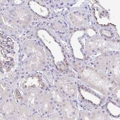 Immunohistochemistry: LENG9 Antibody [NBP2-30893] - Staining of human kidney shows strong granular cytoplasmic positivity in a subset of tubules.