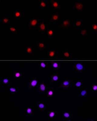 Immunocytochemistry/Immunofluorescence: LEO1 Antibody [NBP3-16704] - Immunofluorescence analysis of NIH/3T3 cells using LEO1 Rabbit pAb (NBP3-16704) at dilution of 1:50 (40x lens). Blue: DAPI for nuclear staining.