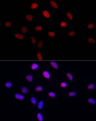 Immunocytochemistry/Immunofluorescence: LEO1 Antibody [NBP3-16704] - Immunofluorescence analysis of U2OS cells using LEO1 Rabbit pAb (NBP3-16704) at dilution of 1:50 (40x lens). Blue: DAPI for nuclear staining.