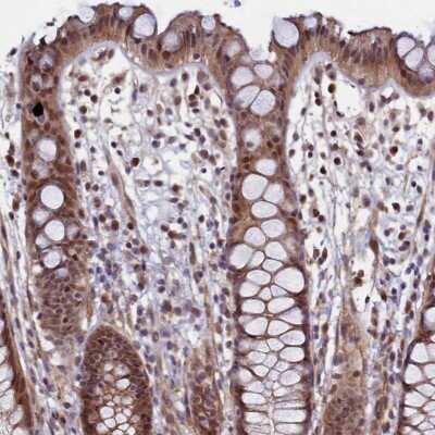 Immunohistochemistry-Paraffin: LEO1 Antibody [NBP1-86236] - Staining of human rectum shows moderate nuclear and cytoplasmic positivity in glandular cells.