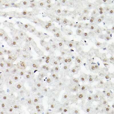 Immunohistochemistry-Paraffin: LEO1 Antibody [NBP3-16704] - Immunohistochemistry of paraffin-embedded mouse liver using LEO1 Rabbit pAb (NBP3-16704) at dilution of 1:100 (40x lens).Perform high pressure antigen retrieval with 10 mM citrate buffer pH 6.0 before commencing with IHC staining protocol.