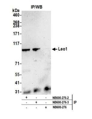 Immunoprecipitation: LEO1 Antibody [NB600-276] - Detection of human Leo1 by western blot of immunoprecipitates. Samples: Whole cell lysate (1.0 mg per IP reaction; 20% of IP loaded) from HeLa cells prepared using NETN lysis buffer. Antibodies: Affinity purified rabbit anti-Leo1 antibody [NB600-276] (lot 3) used for IP at 6 ug per reaction. Leo1 was also immunoprecipitated by a previous lot of this antibody (lot 2). For blotting immunoprecipitated Leo1, NB600-276 was used at 0.04 ug/ml. Detection: Chemiluminescence with an exposure time of 75 seconds.