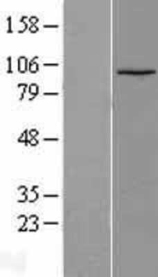 Western Blot: LEO1 Overexpression Lysate (Adult Normal) [NBL1-12488] Left-Empty vector transfected control cell lysate (HEK293 cell lysate); Right -Over-expression Lysate for LEO1.