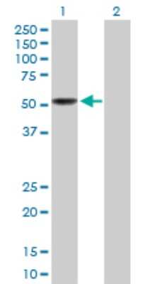 Western Blot: LEPRE1 Antibody [H00064175-D01P] - Analysis of LEPRE1 expression in transfected 293T cell line by LEPRE1 polyclonal antibody.Lane 1: LEPRE1 transfected lysate(42.90 KDa).Lane 2: Non-transfected lysate.