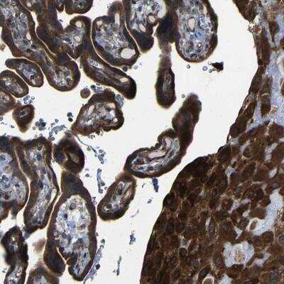 Immunohistochemistry: LEPREL1 Antibody [NBP1-94042] - Staining of human placenta shows strong cytoplasmic positivity in trophoblastic cells and decidua cells.