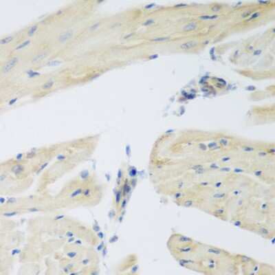 Immunohistochemistry-Paraffin: LEPREL2 Antibody [NBP3-05068] - Paraffin-embedded mouse heart using LEPREL2 antibody at dilution of 1:200 (40x lens).