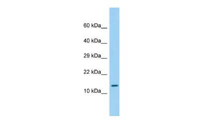 Western Blot: LEPROTL1 Antibody [NBP2-83143] - Host: Rabbit. Target Name: LEPROTL1. Sample Type: Fetal Liver lysates. Antibody Dilution: 1.0ug/ml