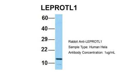 Western Blot: LEPROTL1 Antibody [NBP2-83143] - Host: Rabbit. Target Name: LEPROTL1. Sample Type: Human Hela. Antibody Dilution: 1.0ug/mlLEPROTL1 is supported by BioGPS gene expression data to be expressed in HeLa