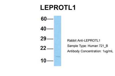 Western Blot: LEPROTL1 Antibody [NBP2-83143] - Host: Rabbit. Target Name: LEPROTL1. Sample Type: Human 721_B. Antibody Dilution: 1.0ug/mlLEPROTL1 is supported by BioGPS gene expression data to be expressed in 721_B