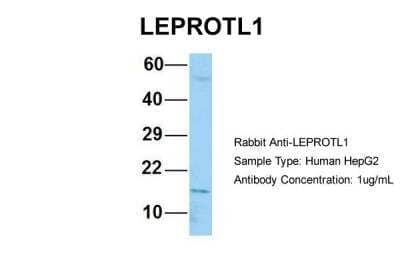 Western Blot: LEPROTL1 Antibody [NBP2-83143] - Host: Rabbit. Target Name: LEPROTL1. Sample Type: Human HepG2. Antibody Dilution: 1.0ug/mlLEPROTL1 is strongly supported by BioGPS gene expression data to be expressed in Human HepG2 cells