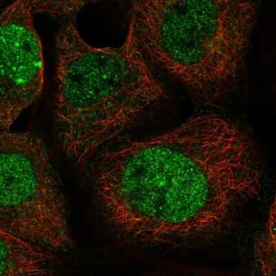 Immunocytochemistry/ Immunofluorescence LETM2 Antibody