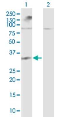 Western Blot: LGALS12 Antibody [H00085329-B02P] - Analysis of LGALS12 expression in transfected 293T cell line by LGALS12 polyclonal antibody.  Lane 1: LGALS12 transfected lysate(37.50 KDa). Lane 2: Non-transfected lysate.