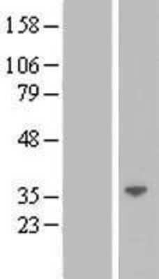 Western Blot: LGALS12 Overexpression Lysate (Adult Normal) [NBL1-12497] Left-Empty vector transfected control cell lysate (HEK293 cell lysate); Right -Over-expression Lysate for LGALS12.