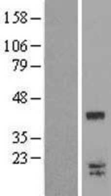 Western Blot: LGALS9C Overexpression Lysate (Adult Normal) [NBL1-12625] Left-Empty vector transfected control cell lysate (HEK293 cell lysate); Right -Over-expression Lysate for LGALS9C.