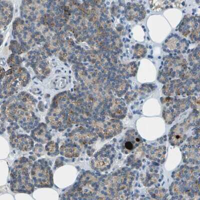 Immunohistochemistry-Paraffin: LGI2 Antibody [NBP1-83839] - Staining of human parathyroid gland shows moderate cytoplasmic positivity in glandular cells.