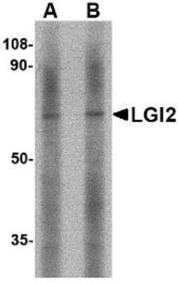 Western Blot: LGI2 Antibody [NBP1-76886] - Mouse liver tissue lysate with LGI2 antibody at (A) 1 and (B) 2 ug/ml.