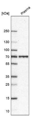 Western Blot: LGI2 Antibody [NBP1-83839] - Analysis in human plasma.