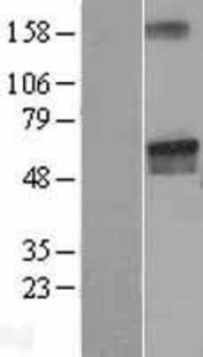 Western Blot: LGI2 Overexpression Lysate (Adult Normal) [NBL1-12507] Left-Empty vector transfected control cell lysate (HEK293 cell lysate); Right -Over-expression Lysate for LGI2.