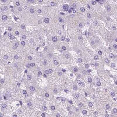 Immunohistochemistry-Paraffin: LGSN Antibody [NBP2-58511] - Staining of human liver.
