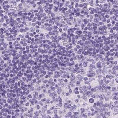 Immunohistochemistry-Paraffin: LGSN Antibody [NBP2-58511] - Staining of human lymph node.