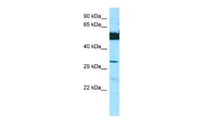 Western Blot: LGSN Antibody [NBP2-85207] - WB Suggested Anti-LGSN Antibody. Titration: 1.0 ug/ml. Positive Control: HepG2 Whole Cell
