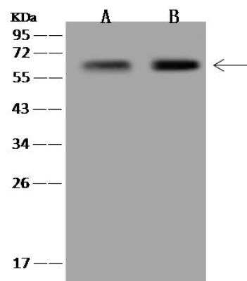 Western Blot: LGSN Antibody [NBP3-12650] - Lane A: HepG2 Whole Cell LysateLane B: U-251MG Whole Cell LysateLysates/proteins at 30 ug per lane.SecondaryGoat Anti-Rabbit IgG (H+L)/HRP at 1/10000 dilution.Developed using the ECL technique.Performed under reducing conditions.Predicted band size:57 kDaObserved band size:57 kDa