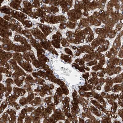 Immunohistochemistry-Paraffin: LGTN Antibody [NBP1-81308] - Staining of human liver shows strong cytoplasmic positivity in hepatocytes.