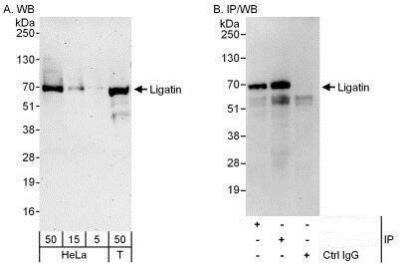 Western Blot: LGTN Antibody [NBP1-50038] - Detection of Human Ligatin by Western Blot and Immunoprecipitation. Samples: Whole cell lysate from HeLa (5, 15 and 50 mcg for WB; 1 mg for IP, 20% of IP loaded) and 293T (T; 50 mcg) cells. Antibodies: Affinity purified rabbit anti-Ligatin antibody used for WB at 0.1 mcg/ml (A) and 1 mcg/ml (B) and used for IP at 6 mcg/mg lysate. Ligatin was also immunoprecipitated by rabbit anti-Ligatin antibody BL10965, which recognizes a downstream epitope. For blotting immunoprecipitated Ligatin, the ReliaBLOT(R) Reagents and Procedures were used. Detection: Chemiluminescence with exposure times of 3 minutes (A) and 30 seconds (B).