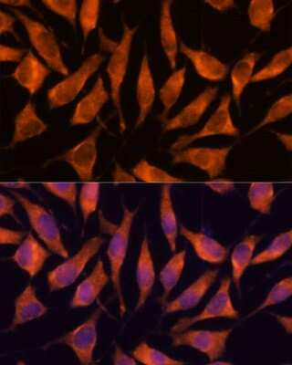 Immunocytochemistry/Immunofluorescence: LHPP Antibody [NBP3-04615] - Analysis of L929 cells using LHPP antibody at dilution of 1:100. Blue: DAPI for nuclear staining.
