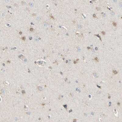 Immunohistochemistry-Paraffin: LHPP Antibody [NBP1-83272] - Staining of human cerebral cortex shows moderate positivity in neurons and glial cells.