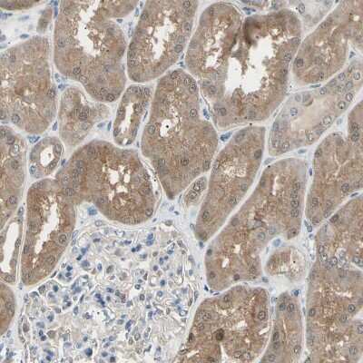 Immunohistochemistry-Paraffin: LHPP Antibody [NBP1-83272] - Staining of human kidney shows moderate cytoplasmic positivity in cells in tubules.