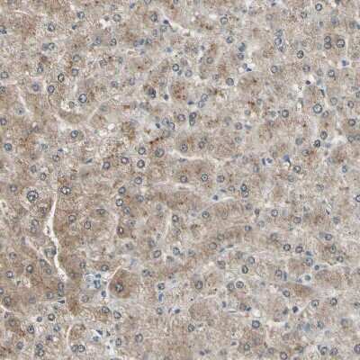 Immunohistochemistry-Paraffin: LHPP Antibody [NBP1-83272] - Staining of human liver shows moderate cytoplasmic positivity in hepatocytes.