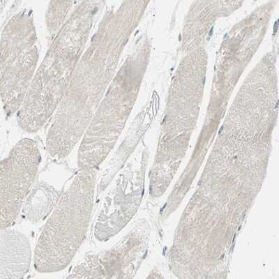Immunohistochemistry-Paraffin: LHPP Antibody [NBP1-83272] - Staining of human skeletal muscle shows very weak positivity in myocytes.