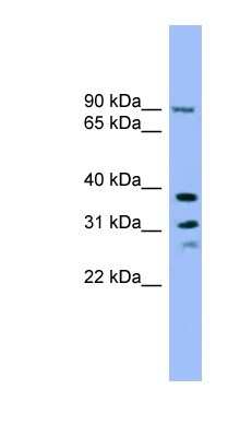 Western Blot: LHPP Antibody [NBP1-70600] - A549 cell lysate, concentration 0.2-1 ug/ml.