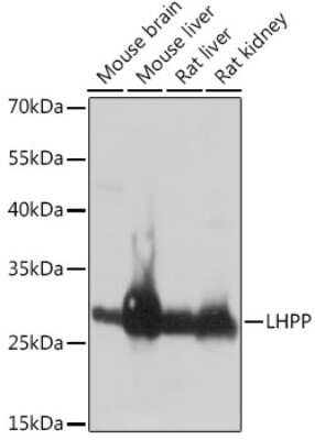 Western Blot: LHPP Antibody [NBP3-04615] - Analysis of extracts of various cell lines, using LHPP antibody at 1:1000 dilution. Secondary antibody: HRP Goat Anti-Rabbit IgG (H+L) at 1:10000 dilution. Lysates/proteins: 25ug per lane. Blocking buffer: 3% nonfat dry milk in TBST. Detection:  ECL Basic Kit