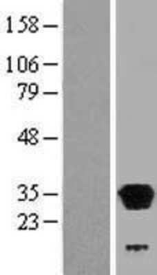 Western Blot: LHPP Overexpression Lysate (Adult Normal) [NBP2-06465] Left-Empty vector transfected control cell lysate (HEK293 cell lysate); Right -Over-expression Lysate for LHPP.