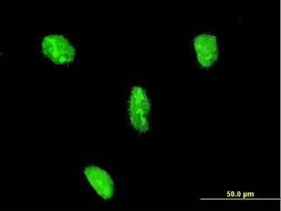 Immunocytochemistry/Immunofluorescence: LHX3 Antibody (2C10) [H00008022-M08] - Analysis of monoclonal antibody to LHX3 on HeLa cell. Antibody concentration 10 ug/ml