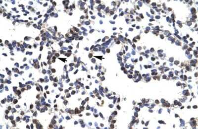 Immunohistochemistry: LHX3 Antibody [NBP2-84135] - Human Lung