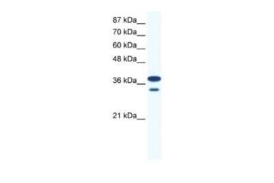 Western Blot: LHX3 Antibody [NBP2-84132] - WB Suggested Anti-LHX3 Antibody Titration: 0.2-1 ug/ml. ELISA Titer: 1:312500. Positive Control: Jurkat cell lysate