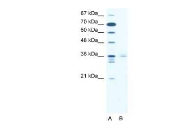 Western Blot: LHX3 Antibody [NBP2-84133] - WB Suggested Anti-LHX3 Antibody. Titration: 2.5 ug/ml. Positive Control: Jurkat Whole Cell