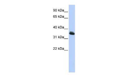 Western Blot: LHX3 Antibody [NBP2-84134] - WB Suggested Anti-LHX3 Antibody Titration: 0.2-1 ug/ml. ELISA Titer: 1:62500. Positive Control: HepG2 cell lysate